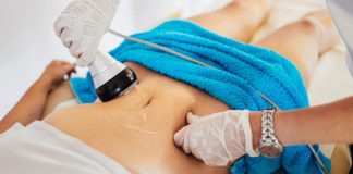 liposuction cost