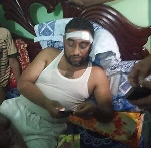 Injured UP chairman Belayet Hossain