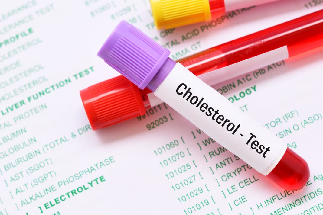 Cholesterol Test Market