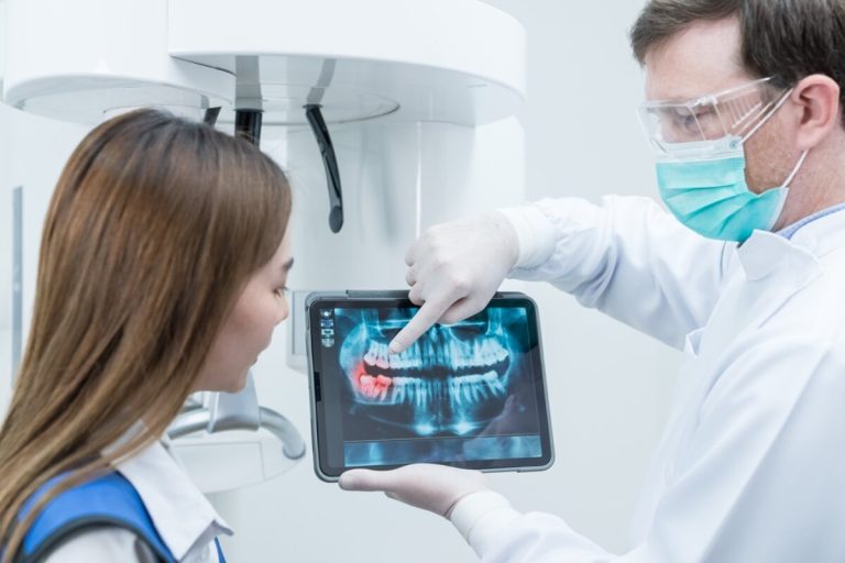 How to Care for Your Dental Implants After Placement