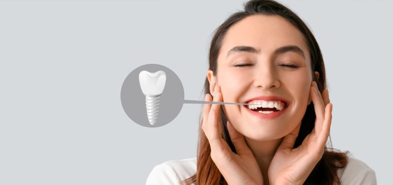 how dental implants replace missing teeth and restore function