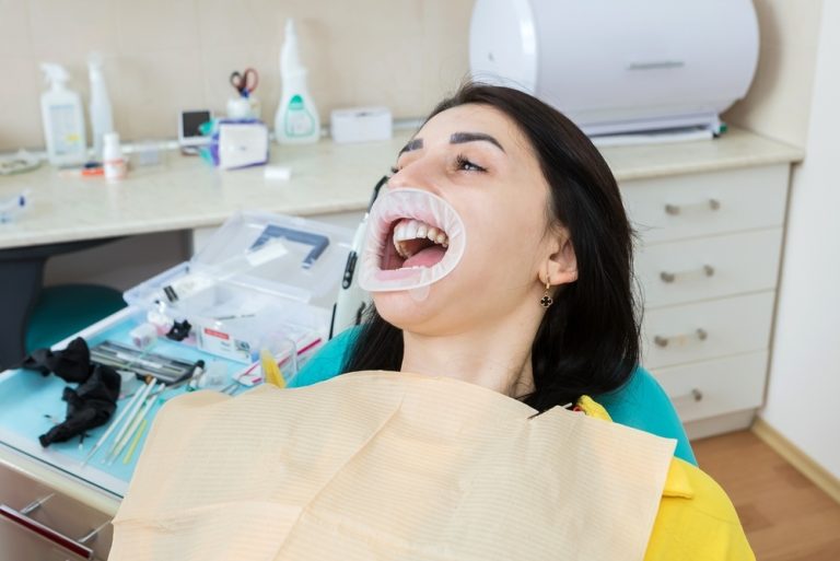 Transform Your Smile with Full Mouth Porcelain Teeth in Edmonton