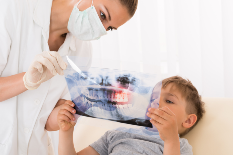dental-xray-for-kids
