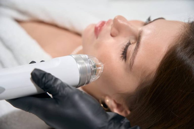 top benefits of microneedling