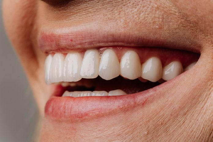 porcelain bridges encino restore missing teeth with a natural smile porcelain bridges encino restore missing teeth with a natural smile