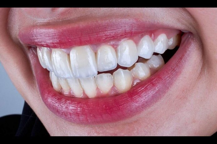 cosmetic dentistry in peterborough cosmetic dentistry in peterborough