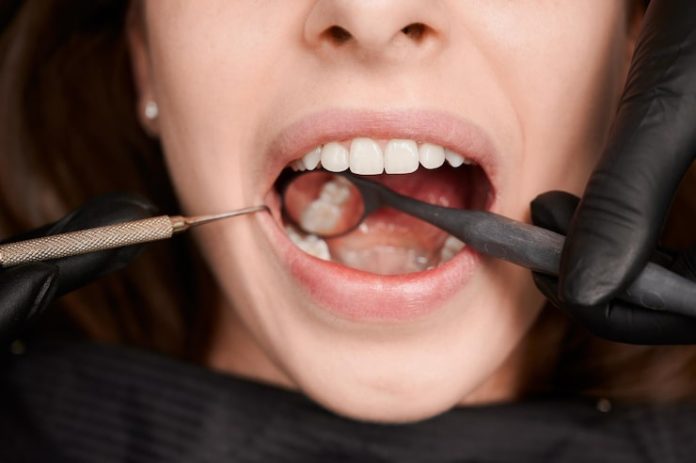 Dental Bridges Near You Dental bridges near you