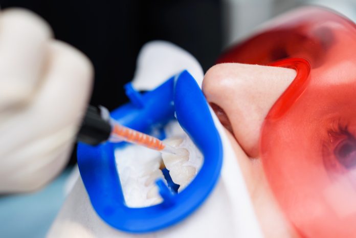 How to Remove Black Spots on Teeth How to Remove Black Spots on Teeth