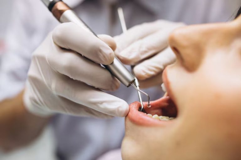Dry Socket After a Tooth Extraction: Symptoms, Causes, and Treatment Options