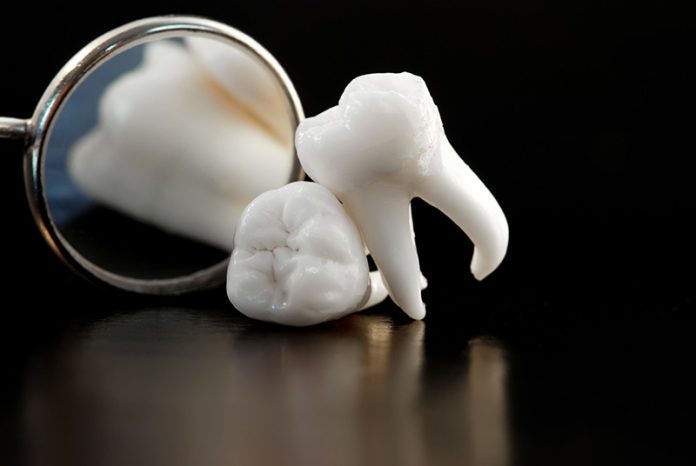 tooth-extraction-procedure-in-saskatoon Tooth Extractions in Saskatoon