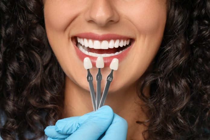 are-porcelain-veneers-a-good-investment-exploring-their-benefits-and-drawbacks porcelain veneers in peterborough