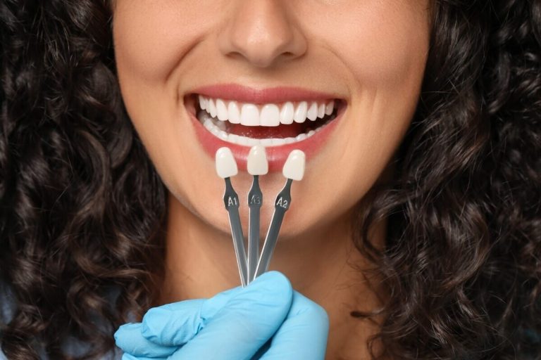 porcelain veneers in peterborough