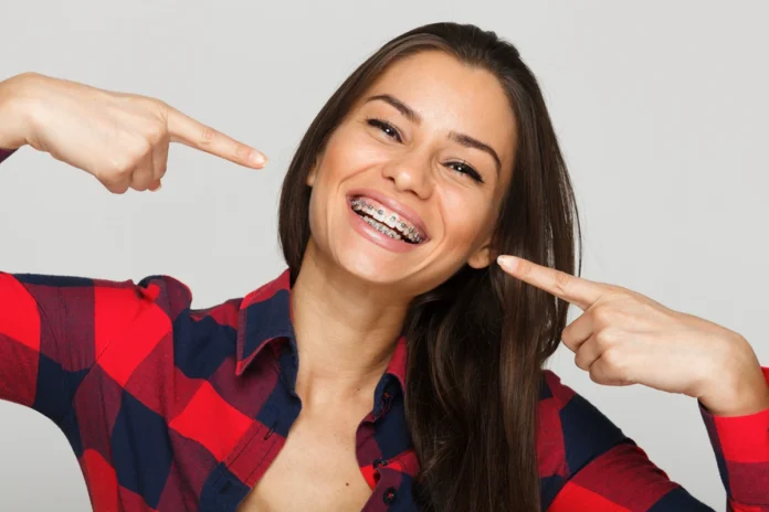 everything you need to know before getting braces