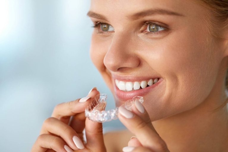 How Invisalign in Richmond Can Improve Your Smile Without Metal Braces