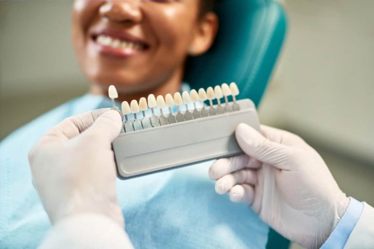 what to expect during the porcelain veneers procedure a step-by-step guide