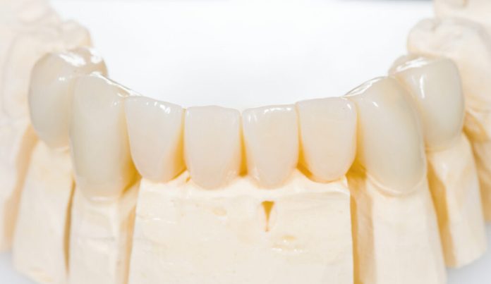denture-cost-canada-factors dentures treatment in edmonton