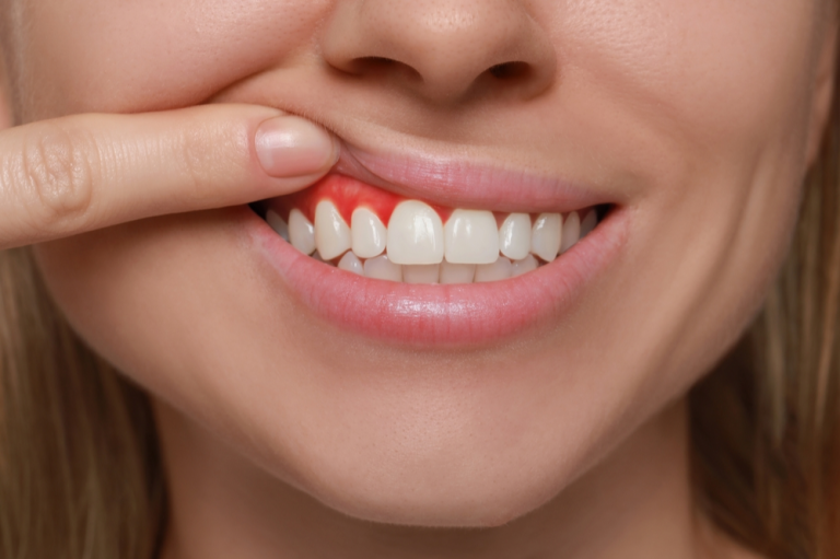 teeth feel itchy